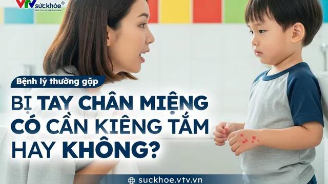 Bị tay chân miệng có cần kiêng tắm không?