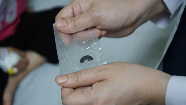 Cấp cứu thành công bệnh nhi 5 tuổi bị hóc dị vật đường thở