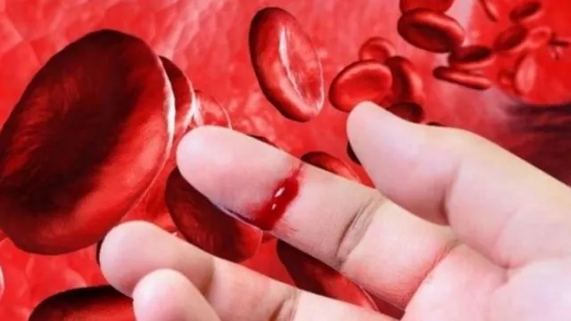 Rối loạn đông máu hiểm họa thầm lặng có thể kiểm soát