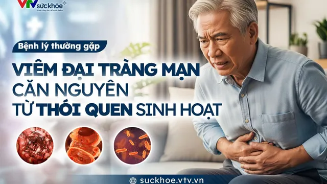 Viêm đại tràng mạn tính - Căn nguyên từ thói quen sinh hoạt