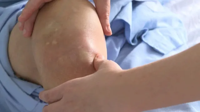 Thoái hóa khớp gối: Hiểu đúng để phòng tránh và điều trị kịp thời