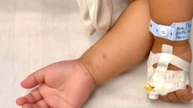 Nguy hiểm rình rập: Bé gái suýt ngộ độc vì uống nhầm thuốc diệt nấm