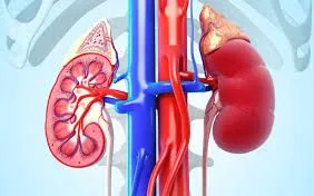 Viêm cầu thận có di truyền không?