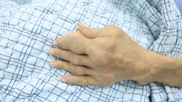 Biến chứng nguy kịch vì tự điều trị gout sai cách
