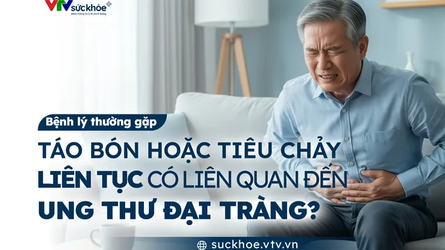 Táo bón, tiêu chảy liên tục có liên quan đến ung thư đại tràng?