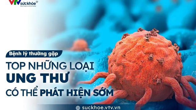 Top những loại ung thư có thể phát hiện sớm