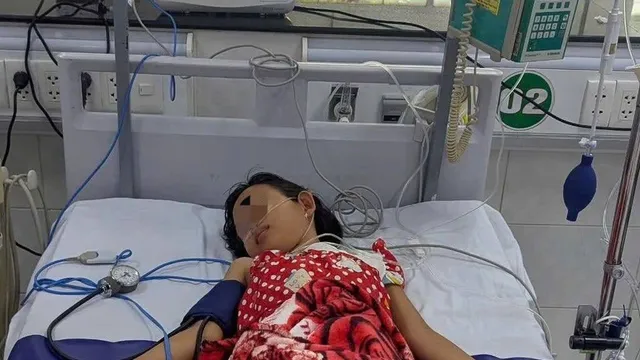 Sốt xuất huyết ở trẻ: Nhập viện muộn, sốc nặng, phải thở máy