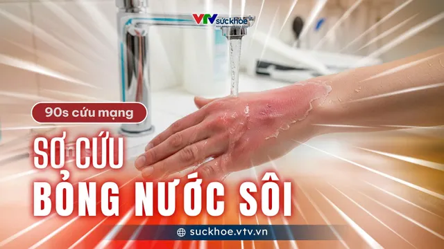 Sơ cứu bỏng nước sôi