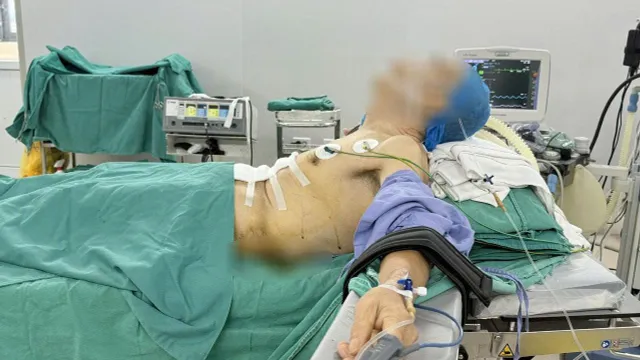 Ca phẫu thuật ung thư dạ dày đặc biệt ở bệnh nhân gù vẹo cột sống nặng