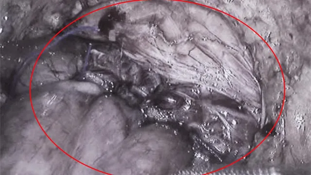 7 năm rong ruổi tìm bệnh của chàng trai mắc hội chứng cực hiếm