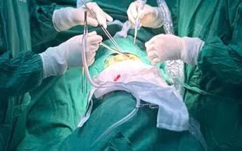 Phát hiện u bàng quang gây xuất huyết kéo dài ở cụ bà 100 tuổi