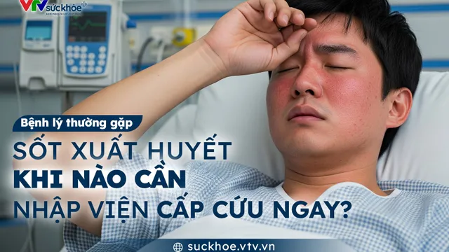 Sốt xuất huyết - khi nào cần nhập viện cấp cứu ngay?