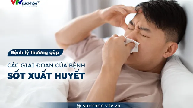 Các giai đoạn của bệnh sốt xuất huyết