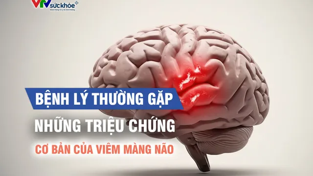 Những triệu chứng cơ bản của viêm màng não