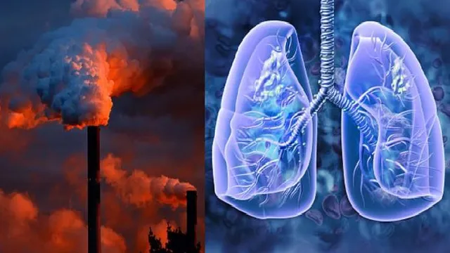 Ngày Phổi Thế giới 2025: "Phổi khỏe cho đời vui"