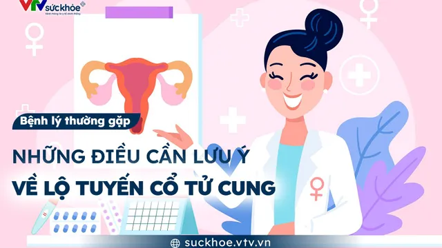 Những điều cần lưu ý về lộ tuyến cổ tử cung