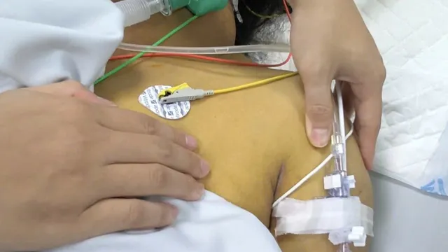 Cảnh báo nguy cơ mắc xoắn khuẩn vàng da mùa mưa lũ