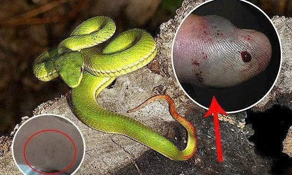 Cảnh báo: Trẻ nhập viện vì rắn cắn trong mùa mưa
