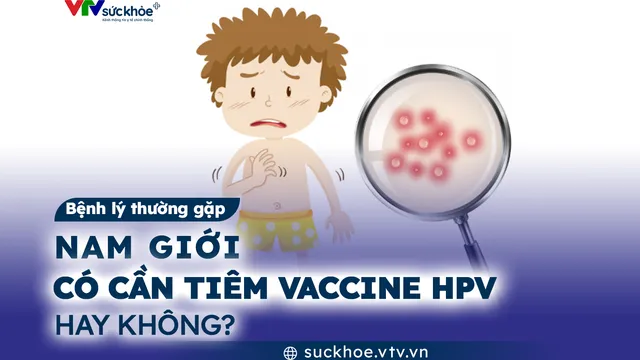 Nam giới có cần tiêm vaccine HPV hay không?