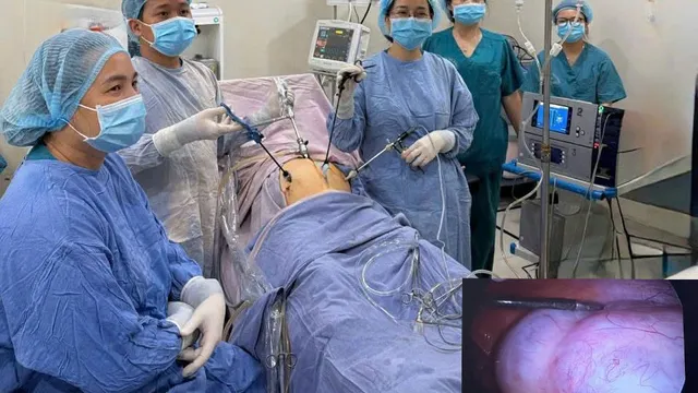 Cứu thai phụ 15 tuần mang khối u buồng trứng khổng lồ