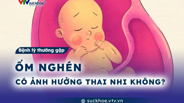 Ốm nghén có ảnh hưởng đến thai nhi không?