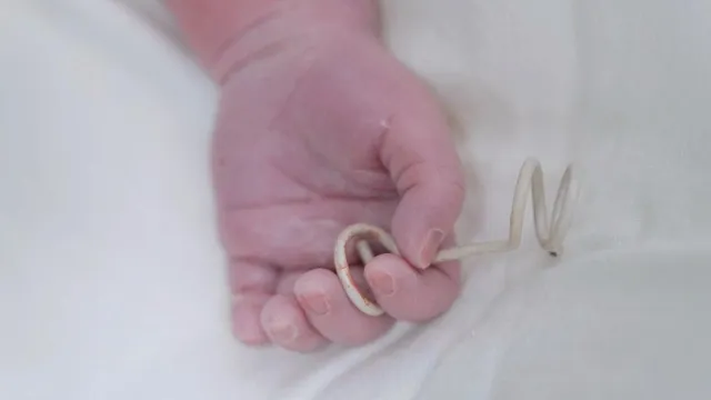 Hành trình hồi sinh kỳ diệu của em bé được cứu sống ngay từ trong bụng mẹ