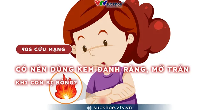 Có nên dùng kem đánh răng, mỡ trăn khi con bị bỏng?