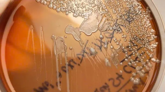 Cảnh giác với bệnh Whitmore