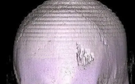 Quên đội mũ bảo hộ, người đàn ông bị vỡ lún xương sọ, suýt mất mạng