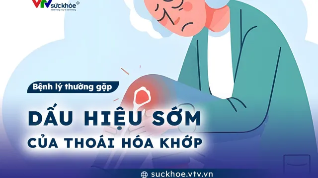 Dấu hiệu sớm của thoái hóa khớp