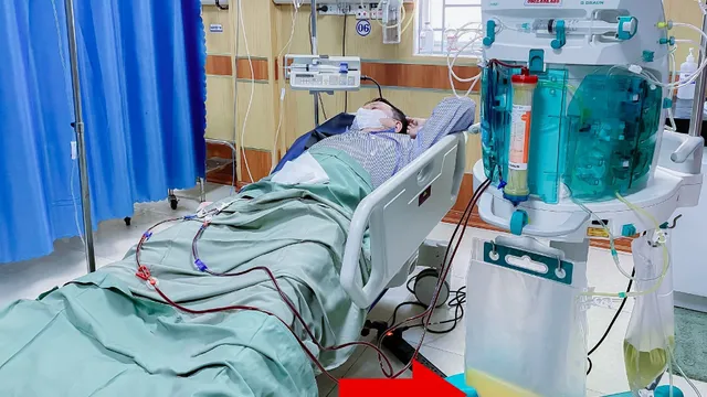 Triglycerid tăng cao gấp nhiều lần, bệnh nhân thoát nguy nhờ lọc máu
