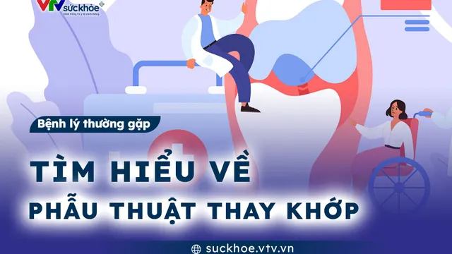 Tìm hiểu về phẫu thuật thay khớp