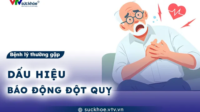 Dấu hiệu báo động đột quỵ
