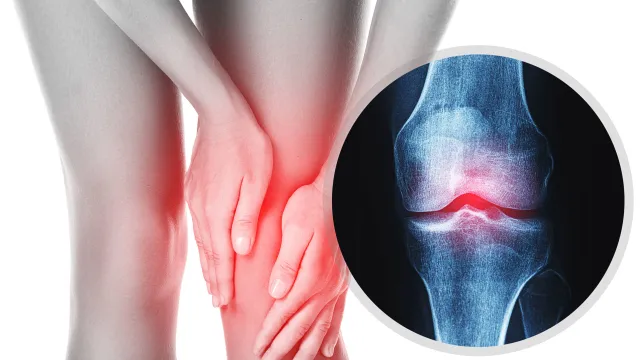 Trời lạnh, đau cơ xương khớp tăng: Chủ động chăm sóc để giảm đau