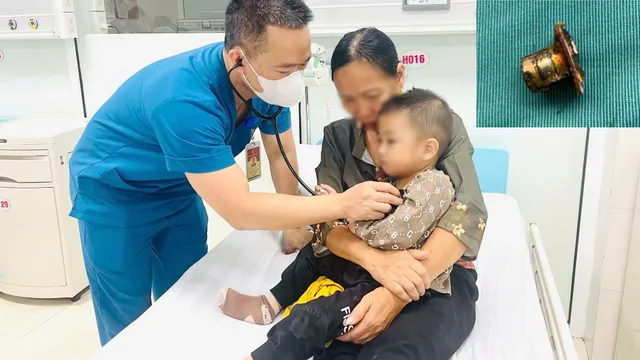 Nguy hiểm: Bé trai 2 tuổi nuốt pin cúc áo, mắc trong thực quản