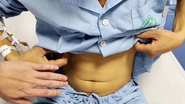 Tổn thương gan, suy thận cấp do ăn, uống mật cá trắm