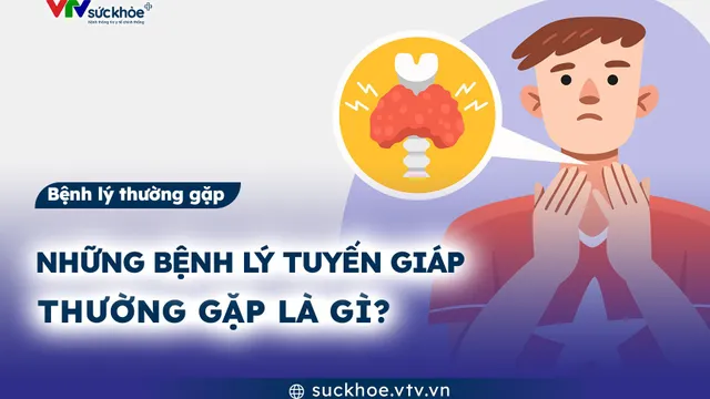 Những bệnh lý tuyến giáp thường gặp là gì?