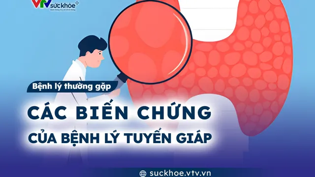 Các biến chứng của bệnh lý tuyến giáp