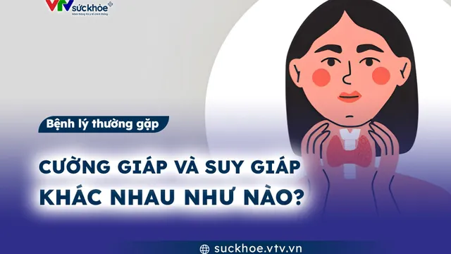 Cường giáp và suy giáp khác nhau như nào?