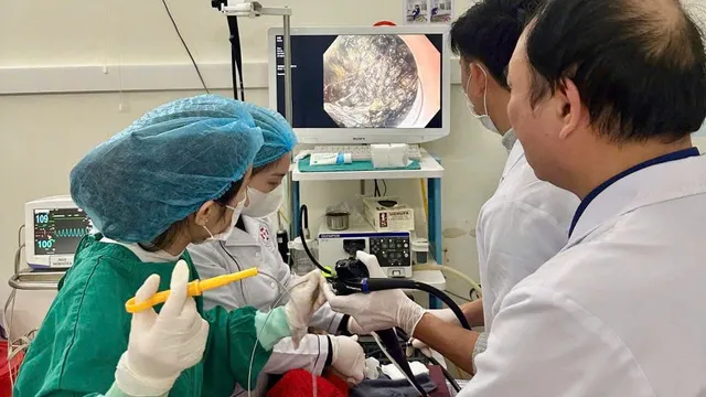 Nội soi gắp búi tóc trong dạ dày, cứu bé 5 tuổi mắc hội chứng Rapunzel