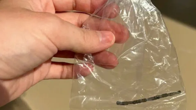 Bé 32 tháng tuổi thủng ruột do nuốt 24 viên nam châm