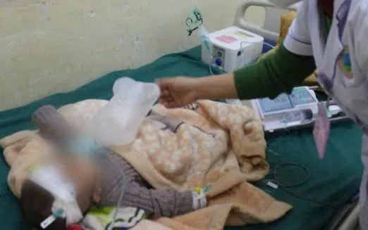 Biến chứng sởi khiến bé 5 tháng tuổi suy hô hấp nguy kịch