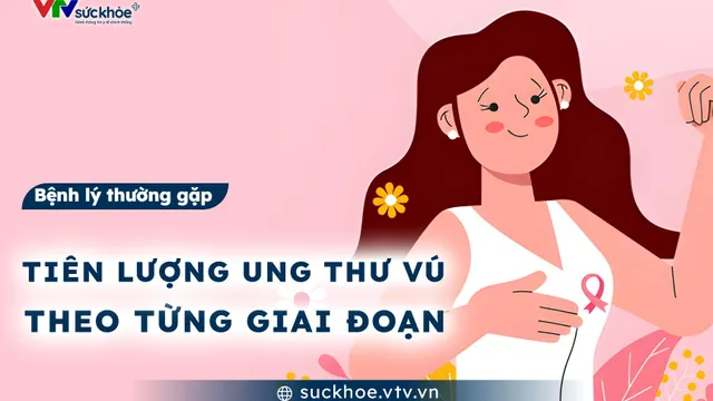 Tiên lượng ung thư vú theo từng giai đoạn