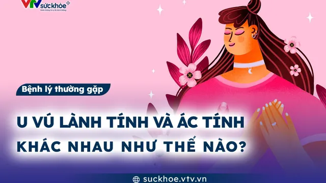 U vú lành tính và ác tính khác nhau như thế nào?