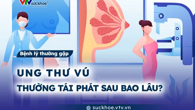 Ung thư vú thường tái phát sau bao lâu?