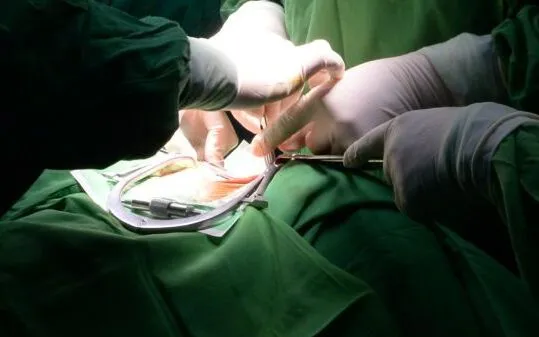 Sỏi đường tiết niệu ở trẻ em: Phát hiện muộn có thể gây suy thận