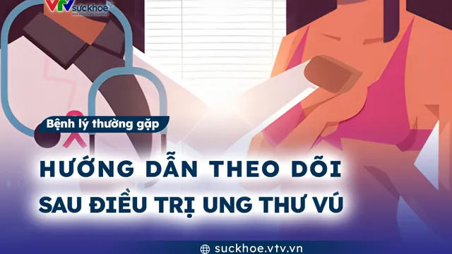 Hướng dẫn theo dõi sau điều trị ung thư vú
