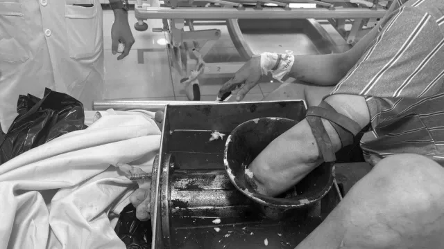 Tai nạn nghiêm trọng từ máy xay thịt: Cảnh báo an toàn lao động