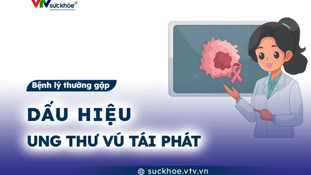 Dấu hiệu ung thư vú tái phát