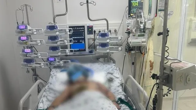 Bé gái 9 tuổi bị lóc da diện rộng do tai nạn giao thông nghiêm trọng